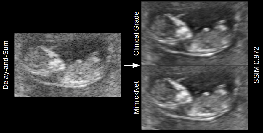 Ultrasound scanner images