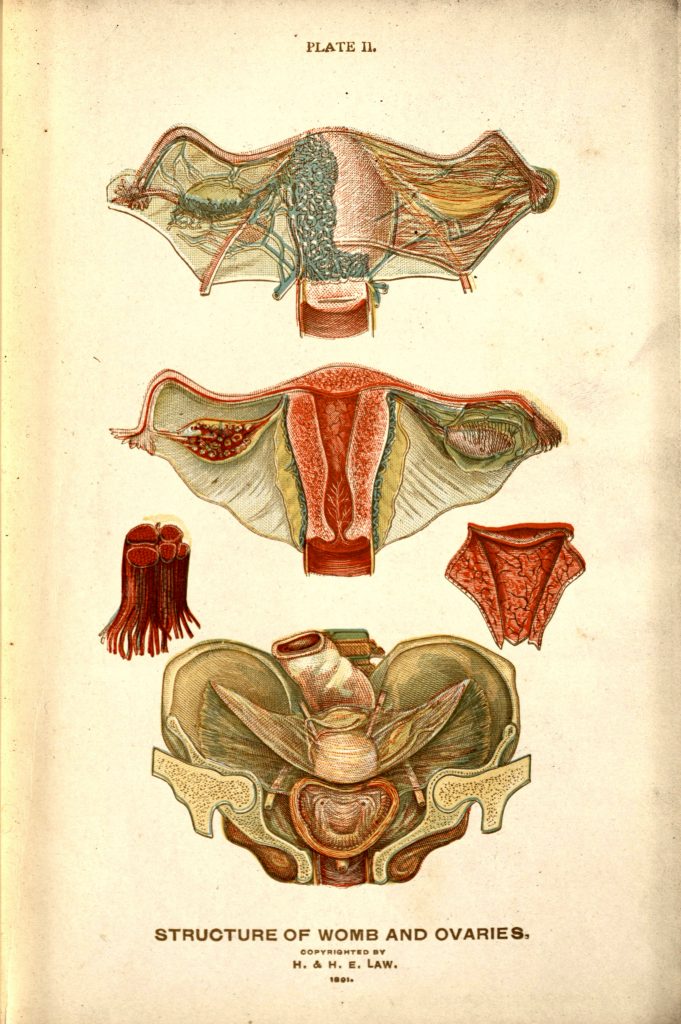 Color illustration of the anatomy of the uterus and ovaries. From The Viavi Gynecological Plates: Designed to Educate Mothers and Daughters Concerning Diseases of the Uterine Organs by Hartland Law. The Viavi Press, 1891.