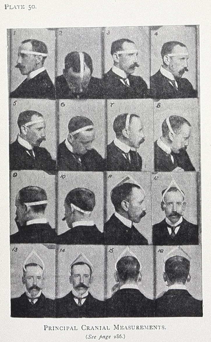 Series of sixteen head shot photographs of a man with dark hair, a mustache, and wearing a dark suit. In each photograph, the man's head is positioned slightly differently showing the placement of a metal tool for measuring the skull. 
